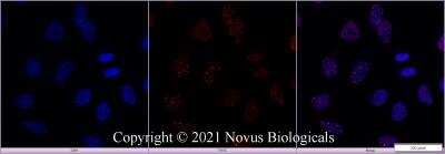 Staining of 53BP1 in HeLa Cells Using Conjugated 53BP1 Antibody